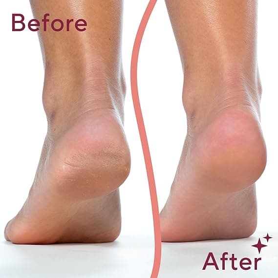 مُنعّم القدم الكهربائي